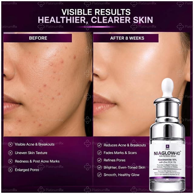 Niaglow 10% Serum 30ml